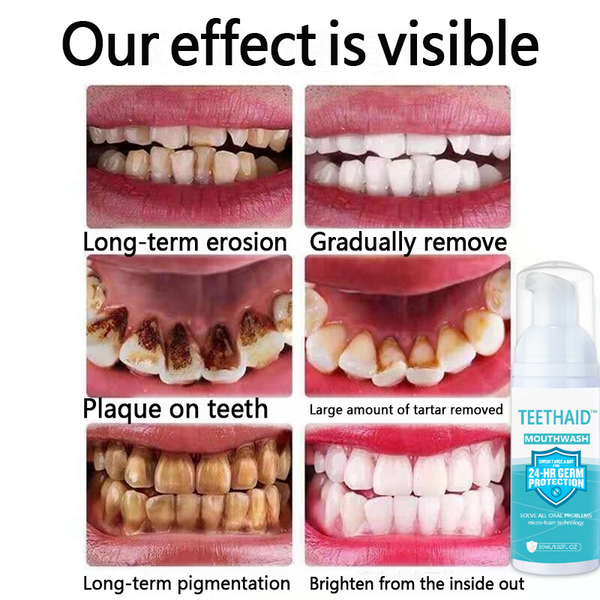🔥"Teethaid™🔥 Enjuague bucal, blanqueamiento dental, Curación de úlceras bucales, Eliminación del mal aliento, Prevención y curación de caries
