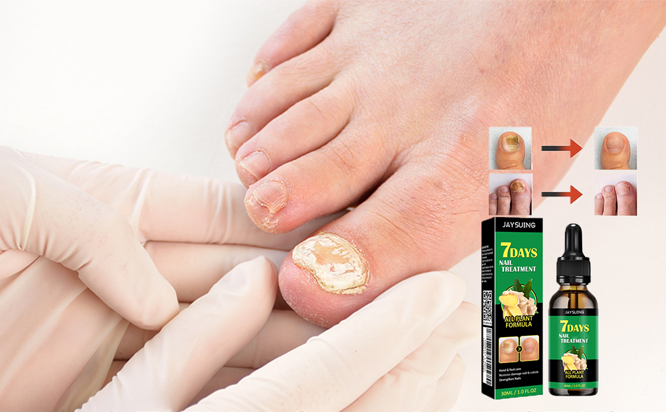 7 DAYS - ELIMINA HONGOS